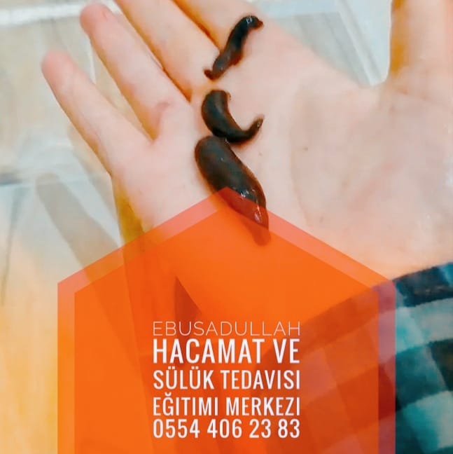 Konya Hacamat Ebusadullah Blog